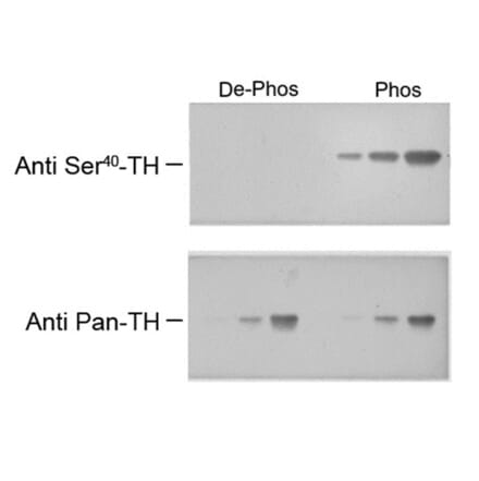 Western Blot - Anti-Tyrosine Hydroxylase (phospho Ser40) Antibody (A283960) - Antibodies.com