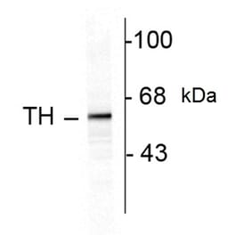Western Blot - Anti-Tyrosine Hydroxylase Antibody (A283964) - Antibodies.com