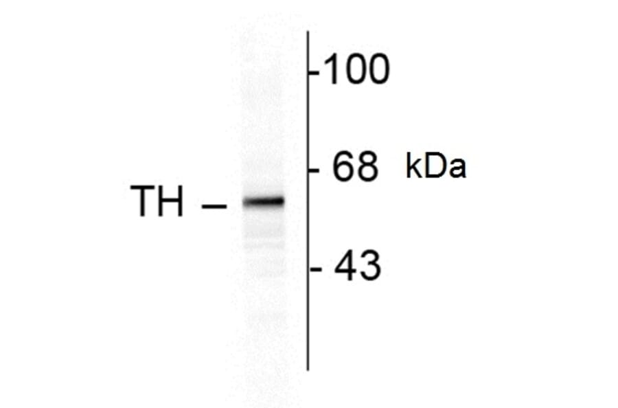 Western Blot - Anti-Tyrosine Hydroxylase Antibody (A283964) - Antibodies.com