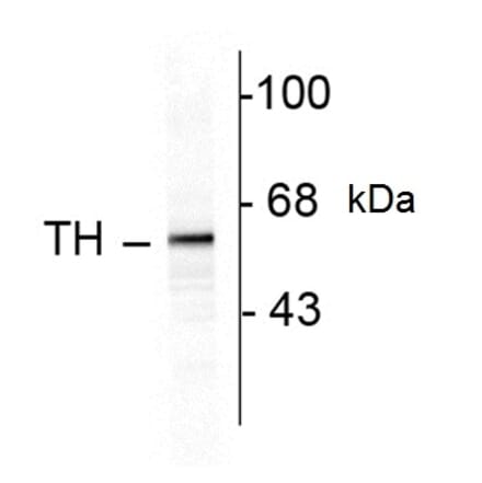 Western Blot - Anti-Tyrosine Hydroxylase Antibody (A283964) - Antibodies.com