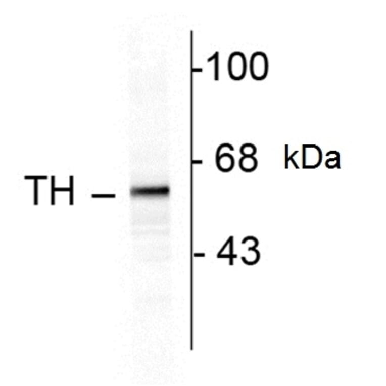 Western Blot - Anti-Tyrosine Hydroxylase Antibody (A283964) - Antibodies.com