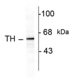 Western Blot - Anti-Tyrosine Hydroxylase Antibody (A283964) - Antibodies.com