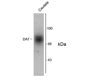 Western Blot - Anti-Dopamine Transporter Antibody (A283965) - Antibodies.com