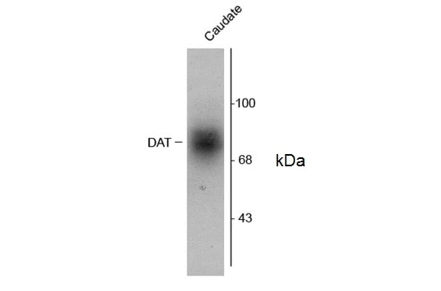Western Blot - Anti-Dopamine Transporter Antibody (A283965) - Antibodies.com