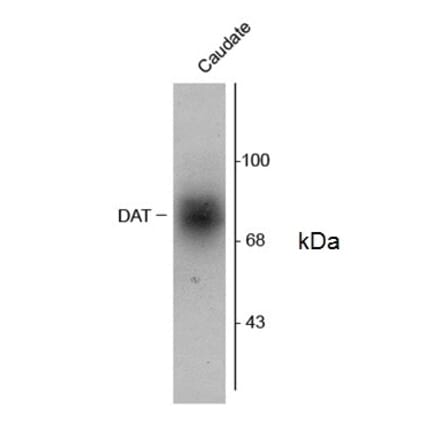 Western Blot - Anti-Dopamine Transporter Antibody (A283965) - Antibodies.com