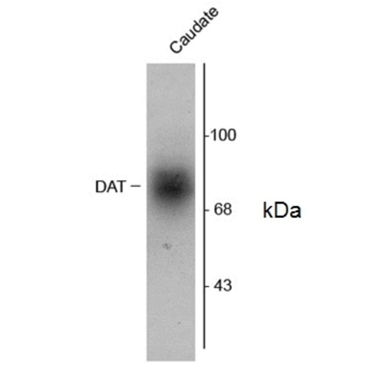 Western Blot - Anti-Dopamine Transporter Antibody (A283965) - Antibodies.com