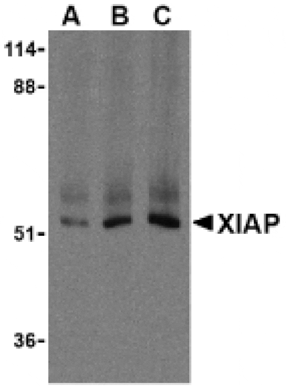 Western Blot - Anti-XIAP Antibody (A283968) - Antibodies.com