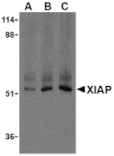 Western Blot - Anti-XIAP Antibody (A283968) - Antibodies.com