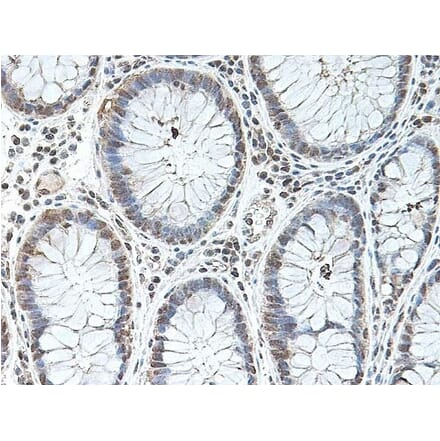 Immunohistochemistry - Anti-BMP2 Antibody (A283982) - Antibodies.com