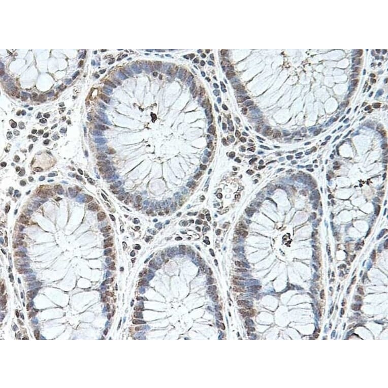 Immunohistochemistry - Anti-BMP2 Antibody (A283982) - Antibodies.com