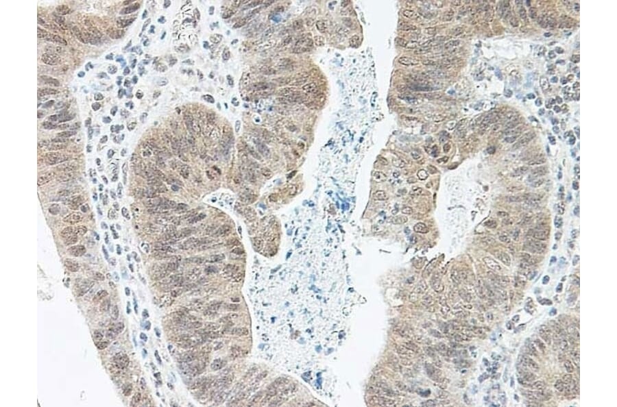 Immunohistochemistry - Anti-BMP2 Antibody (A283982) - Antibodies.com