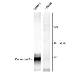 Western Blot - Anti-Connexin 43 / GJA1 (phospho Ser368) Antibody (A283991) - Antibodies.com
