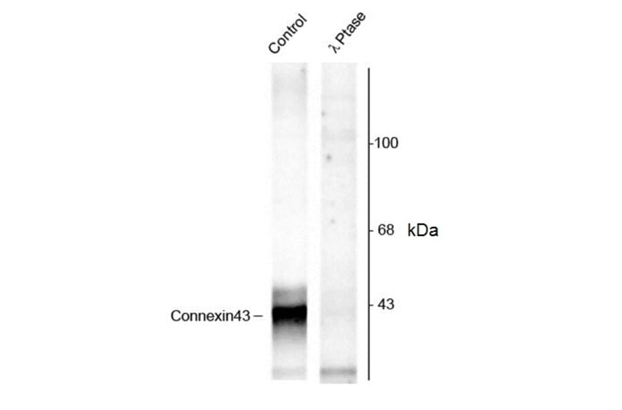 Western Blot - Anti-Connexin 43 / GJA1 (phospho Ser368) Antibody (A283991) - Antibodies.com