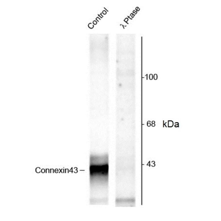 Western Blot - Anti-Connexin 43 / GJA1 (phospho Ser368) Antibody (A283991) - Antibodies.com