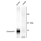 Western Blot - Anti-Connexin 43 / GJA1 (phospho Ser368) Antibody (A283991) - Antibodies.com