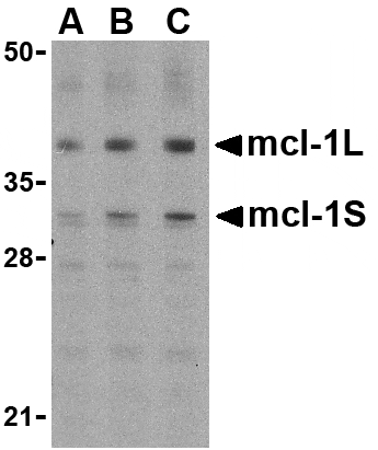 Western Blot - Anti-MCL1 Antibody (A283996) - Antibodies.com