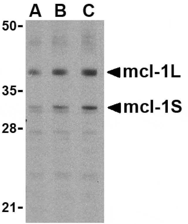 Western Blot - Anti-MCL1 Antibody (A283996) - Antibodies.com