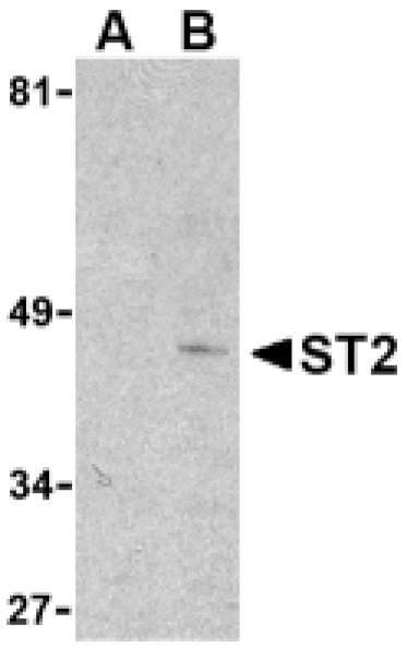 Western Blot - Anti-ST2 Antibody (A283997) - Antibodies.com