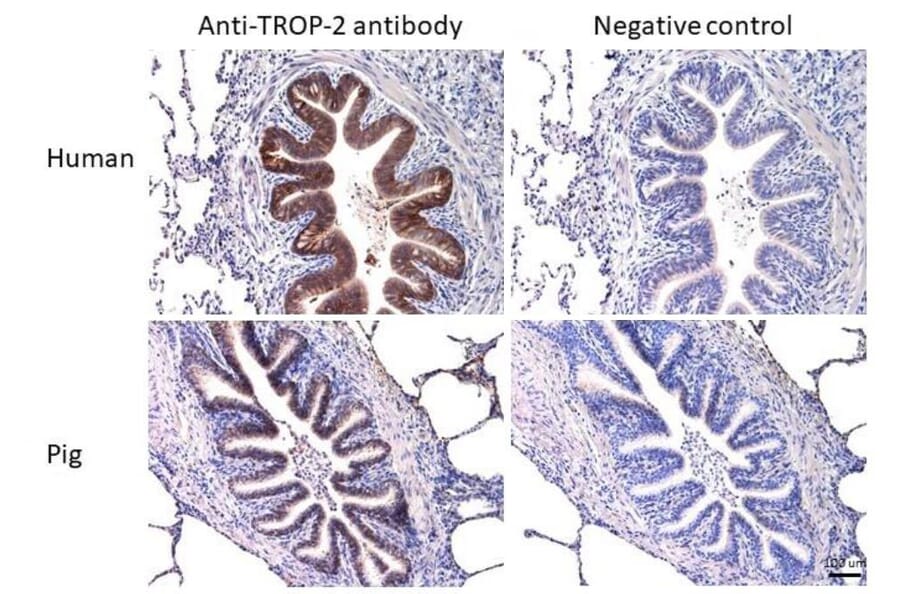 Immunohistochemistry - Anti-TROP2 Antibody [TrMab-6] (A285856) - Antibodies.com