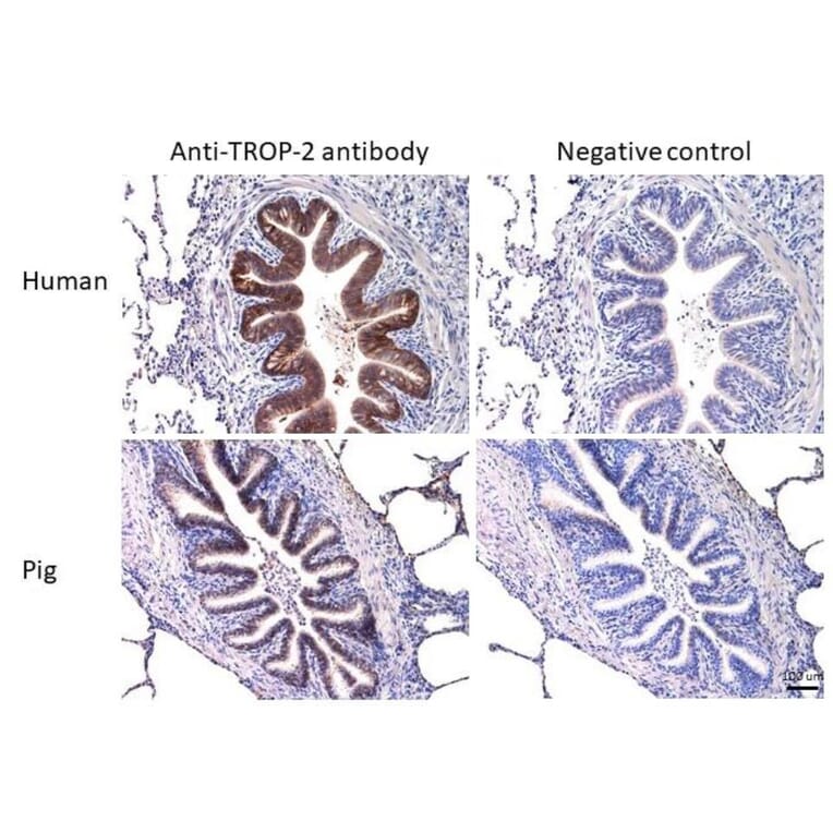 Immunohistochemistry - Anti-TROP2 Antibody [TrMab-6] (A285856) - Antibodies.com