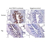 Immunohistochemistry - Anti-TROP2 Antibody [TrMab-6] (A285856) - Antibodies.com