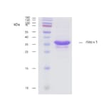 SDS-Page - Recombinant Ves v 1 (1.0101) Protein (A285882) - Antibodies.com