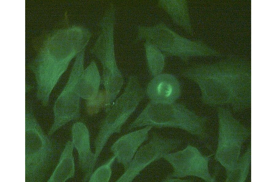 Immunocytochemistry - Anti-beta Tubulin Antibody [TU-06] (Alexa Fluor® 488) (A285918) - Antibodies.com