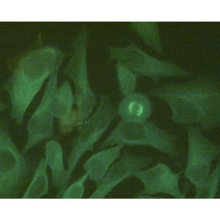 Immunocytochemistry - Anti-beta Tubulin Antibody [TU-06] (Alexa Fluor® 488) (A285918) - Antibodies.com