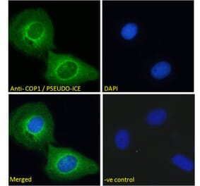 Immunofluorescence - Anti-COP Antibody (A285928) - Antibodies.com