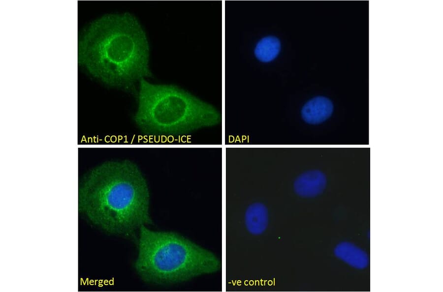 Immunofluorescence - Anti-COP Antibody (A285928) - Antibodies.com