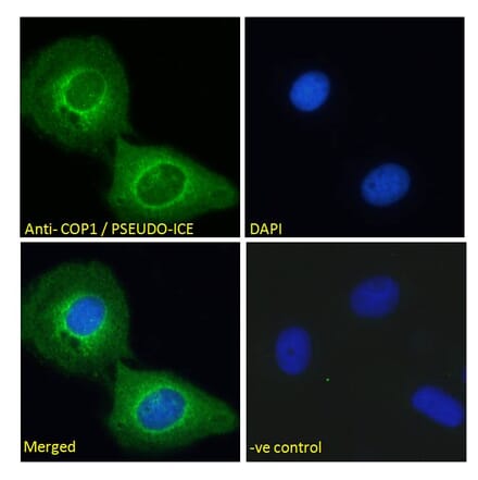 Immunofluorescence - Anti-COP Antibody (A285928) - Antibodies.com