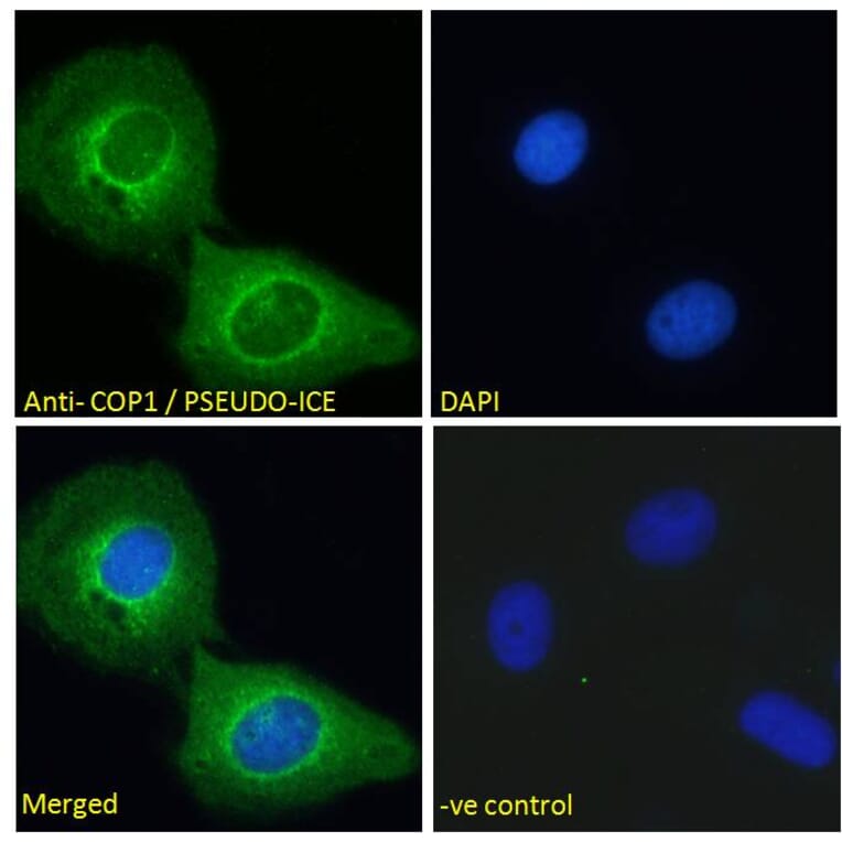 Immunofluorescence - Anti-COP Antibody (A285928) - Antibodies.com