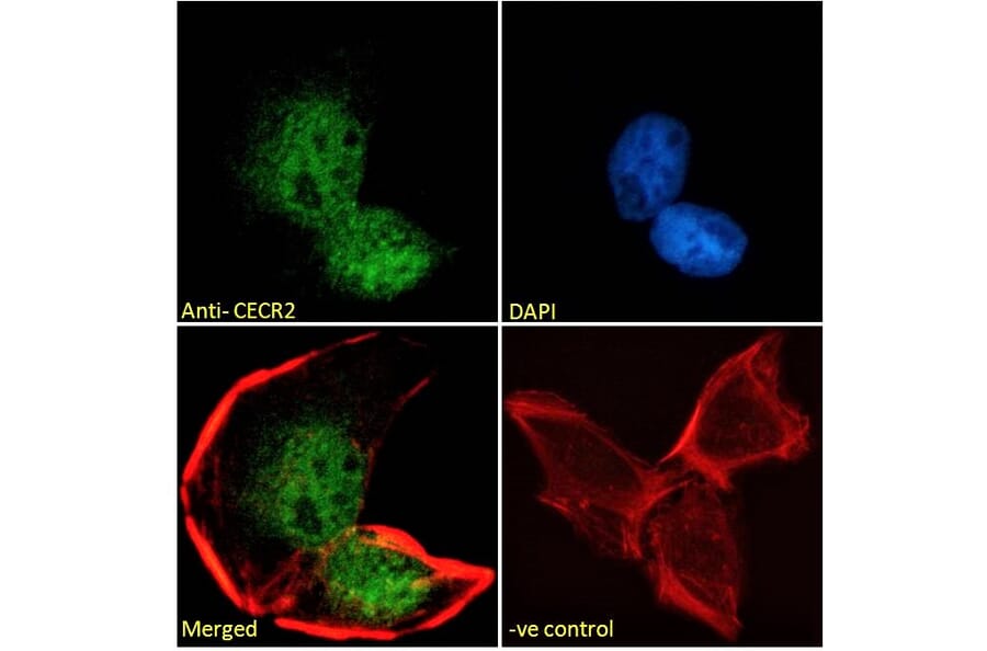 Immunofluorescence - Anti-CECR2 Antibody (A285933) - Antibodies.com