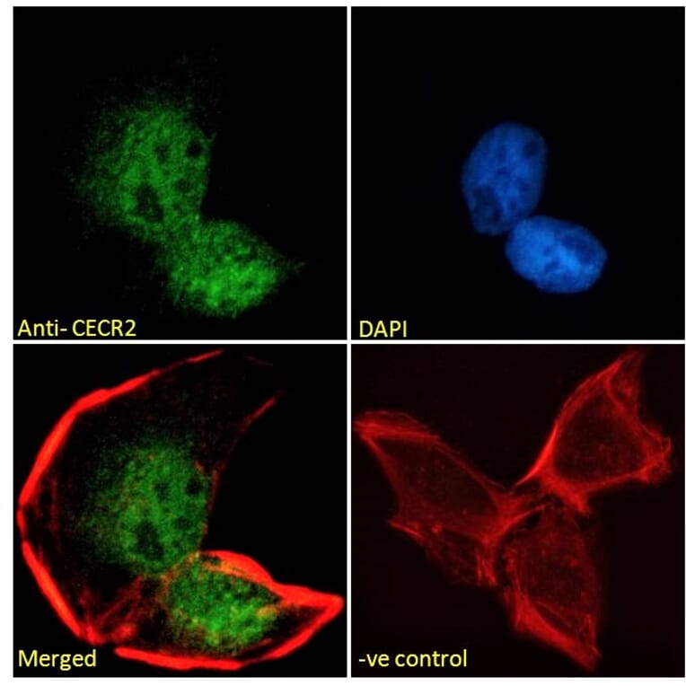 Immunofluorescence - Anti-CECR2 Antibody (A285933) - Antibodies.com