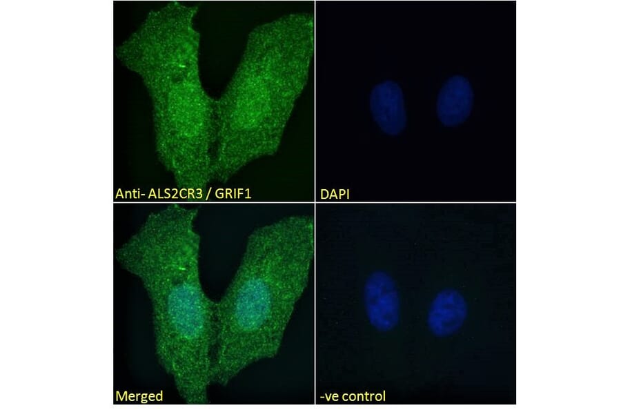 Immunofluorescence - Anti-TRAK2 Antibody (A285934) - Antibodies.com