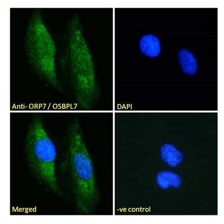 Immunofluorescence - Anti-OSBPL7 Antibody (A285936) - Antibodies.com