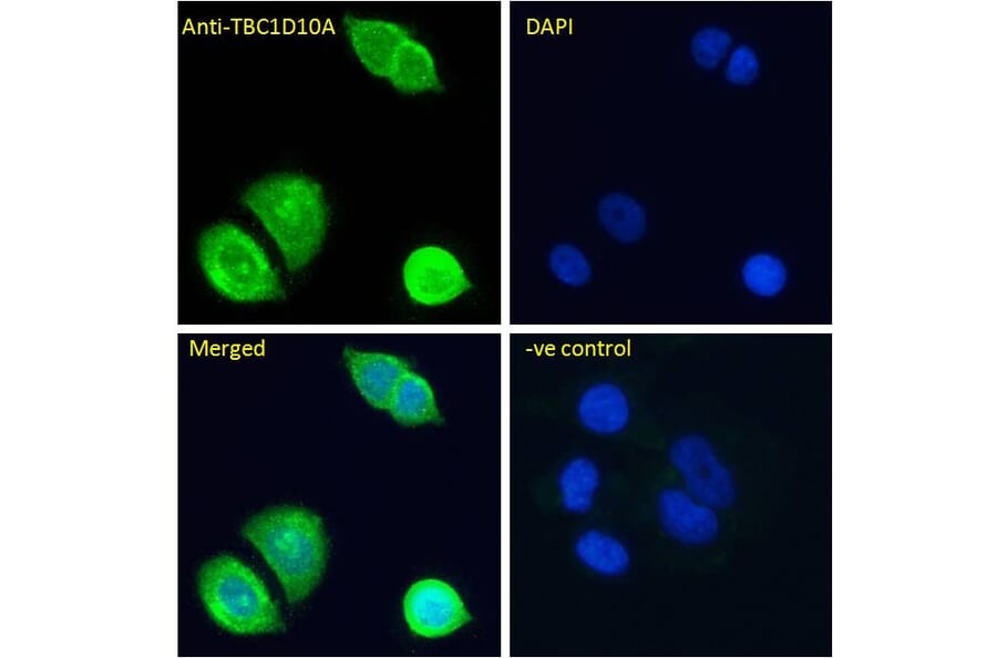 Immunofluorescence - Anti-EPI64/TBC1D10A Antibody (A285937) - Antibodies.com