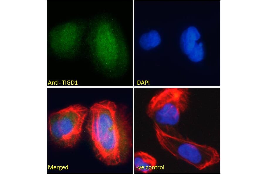 Immunofluorescence - Anti-TIGD1 Antibody (A285939) - Antibodies.com