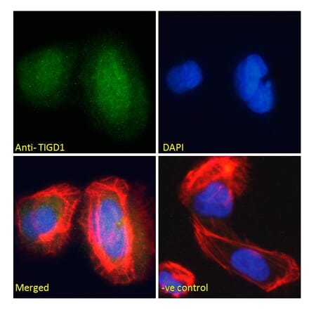 Immunofluorescence - Anti-TIGD1 Antibody (A285939) - Antibodies.com