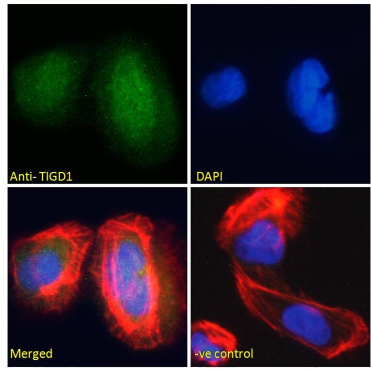 Immunofluorescence - Anti-TIGD1 Antibody (A285939) - Antibodies.com