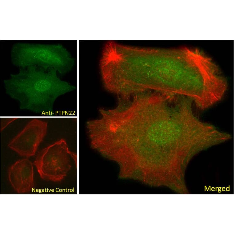 Immunofluorescence - Anti-PTPN22 Antibody (A285945) - Antibodies.com