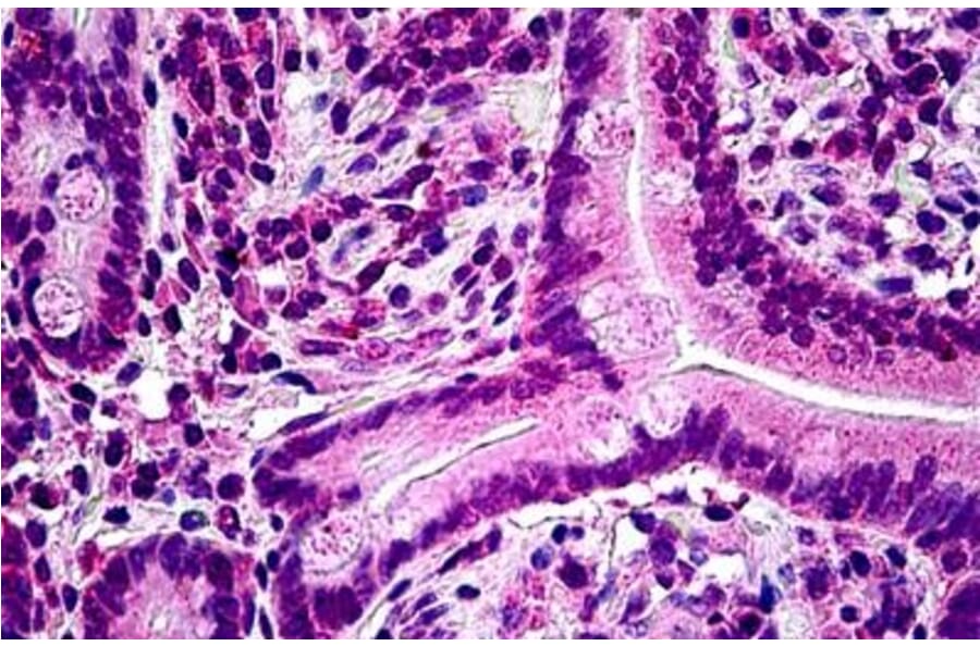 Immunohistochemistry - Anti-PTPN22 Antibody (A285945) - Antibodies.com