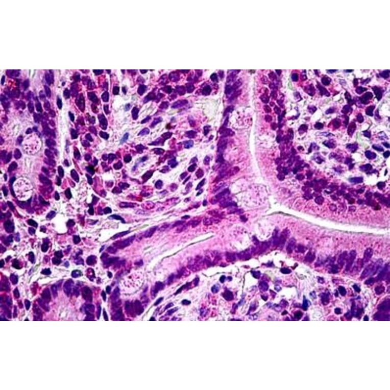 Immunohistochemistry - Anti-PTPN22 Antibody (A285945) - Antibodies.com