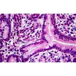 Immunohistochemistry - Anti-PTPN22 Antibody (A285945) - Antibodies.com