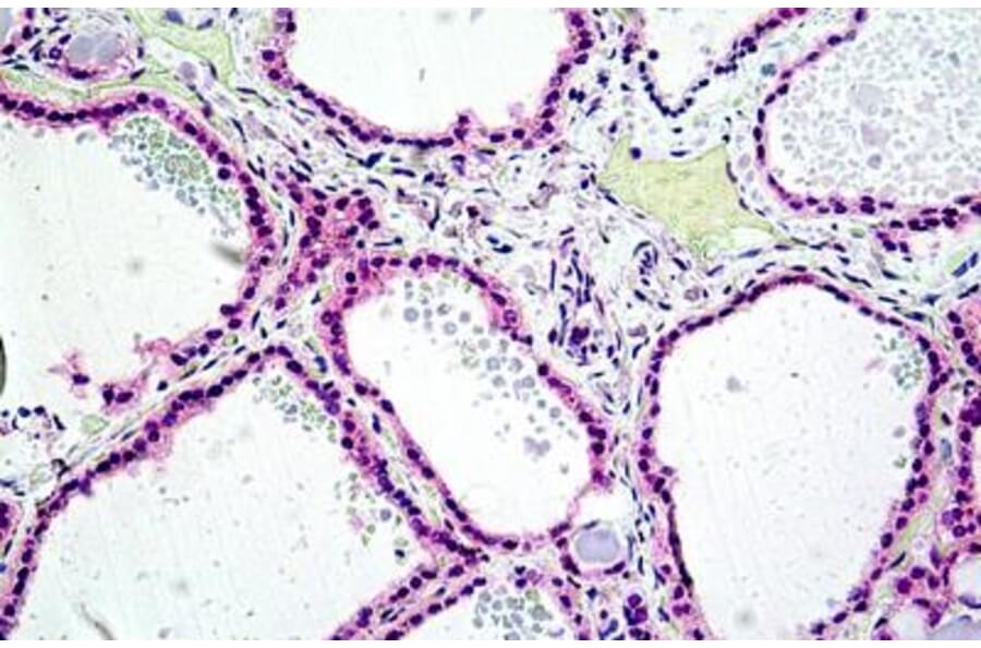 Immunohistochemistry - Anti-PTPN22 Antibody (A285945) - Antibodies.com