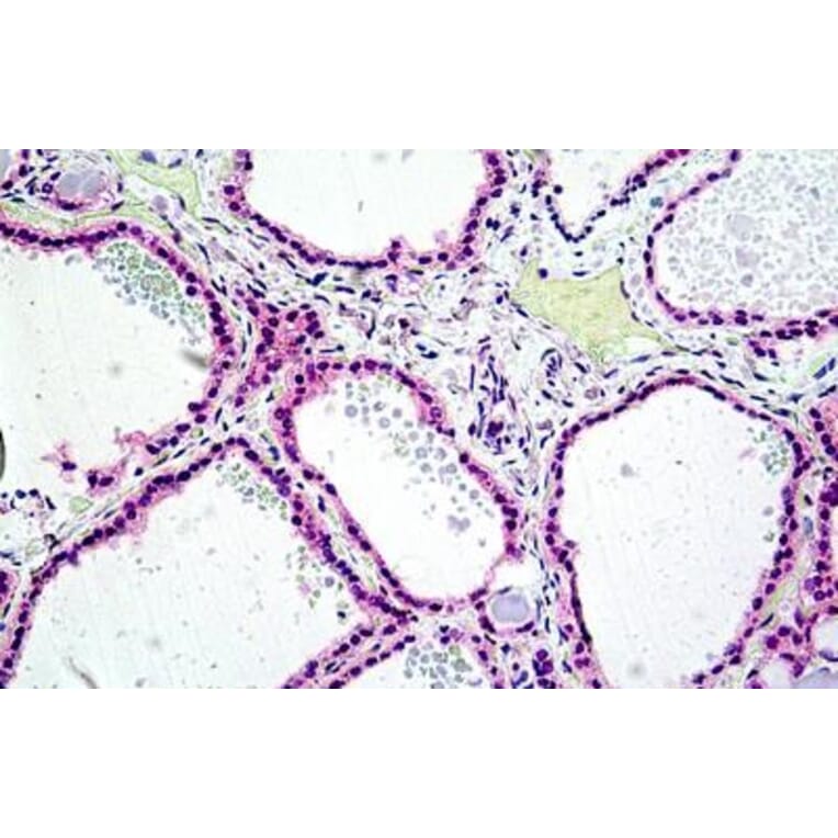 Immunohistochemistry - Anti-PTPN22 Antibody (A285945) - Antibodies.com