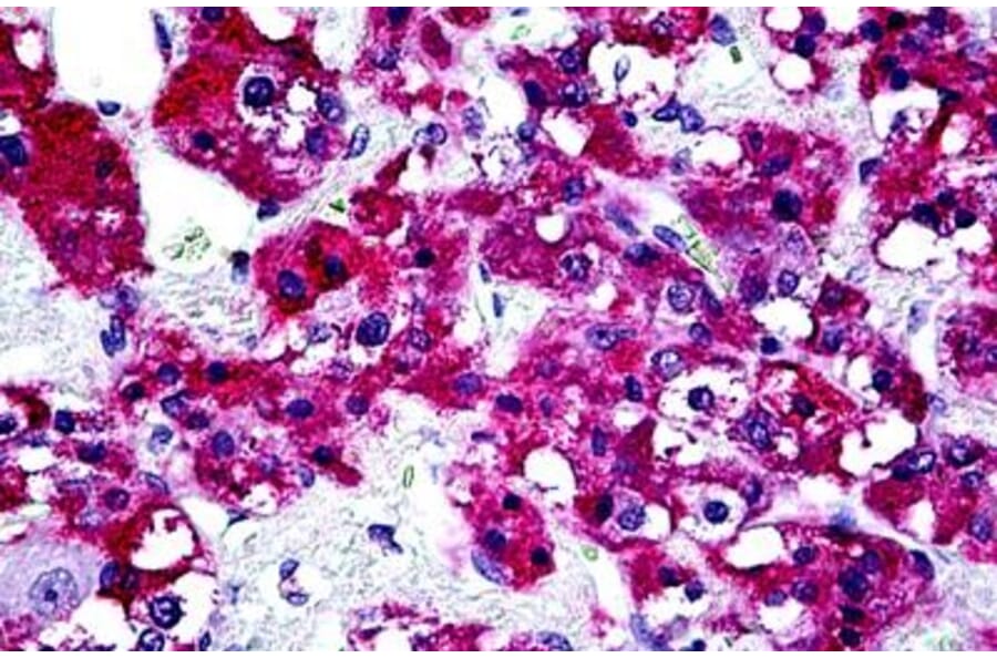 Immunohistochemistry - Anti-PTPN22 Antibody (A285945) - Antibodies.com