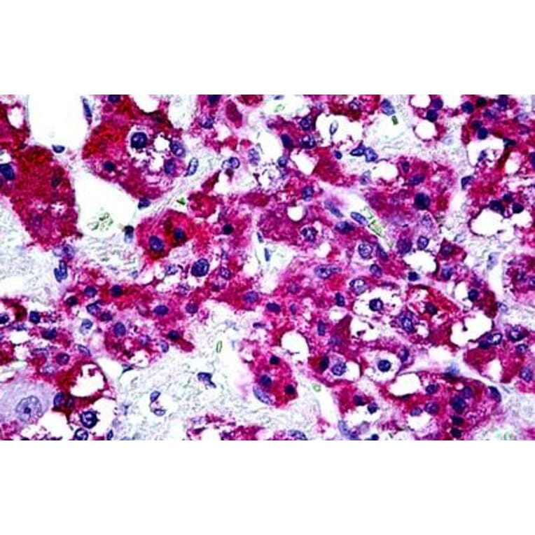 Immunohistochemistry - Anti-PTPN22 Antibody (A285945) - Antibodies.com