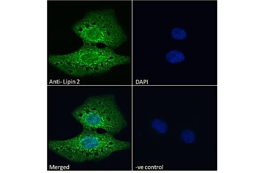 Immunofluorescence - Anti-Lipin 2/LPIN2 Antibody (A285946) - Antibodies.com