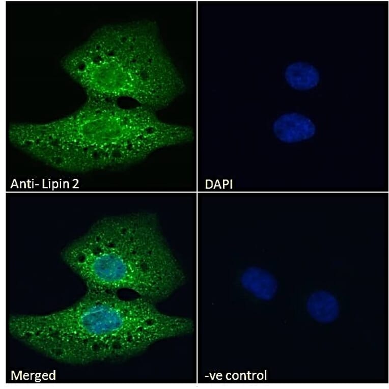 Immunofluorescence - Anti-Lipin 2/LPIN2 Antibody (A285946) - Antibodies.com